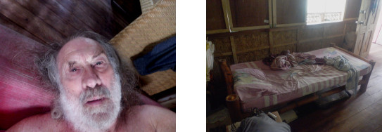 Images of sick man after typhoon Rai