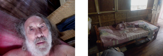 Images of sick man after typhoon Rai