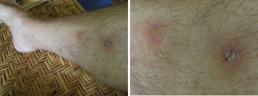 Images of leg healing