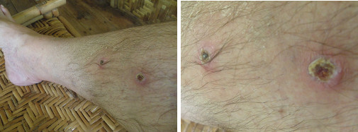 Images of leg healing -day 12